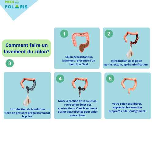 Kit de lavement en RUPTURE sur site - DISPONIBLE AMAZON